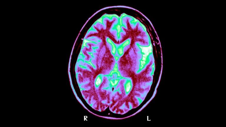 Brain-scan-GettyImages-151036433